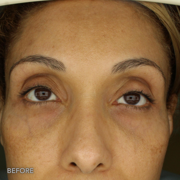 After transformation 3