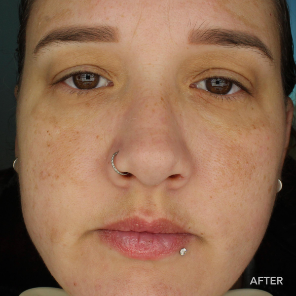Before transformation 4
