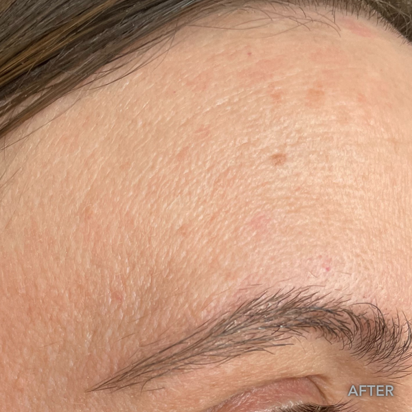 After transformation 2