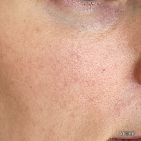 After transformation 3