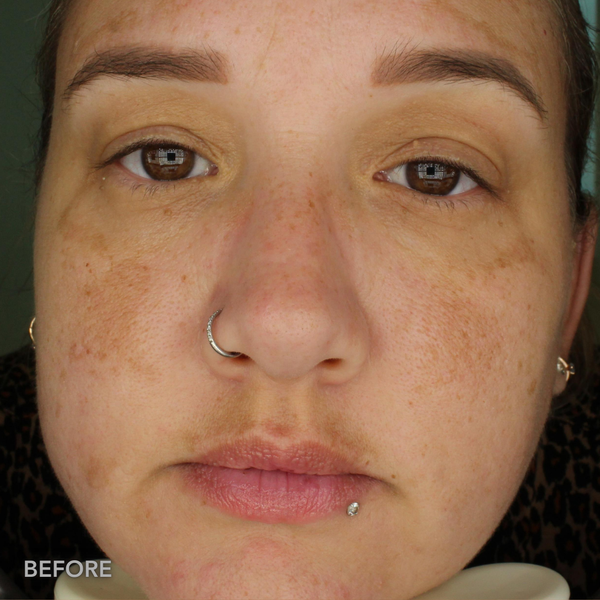 After transformation 4