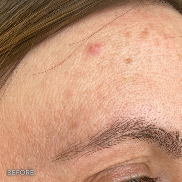 Before transformation 2