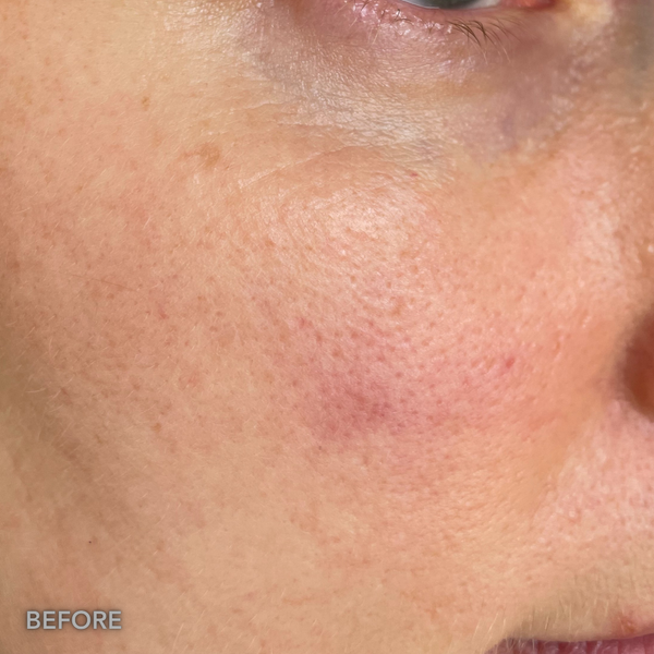 Before transformation 3