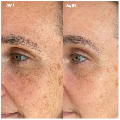 Marine Antioxidant Serum